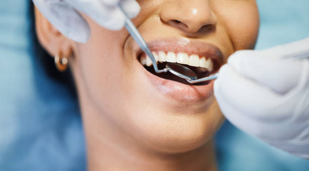 Best Emergency Dental Services for Seniors in Chubbuck, ID